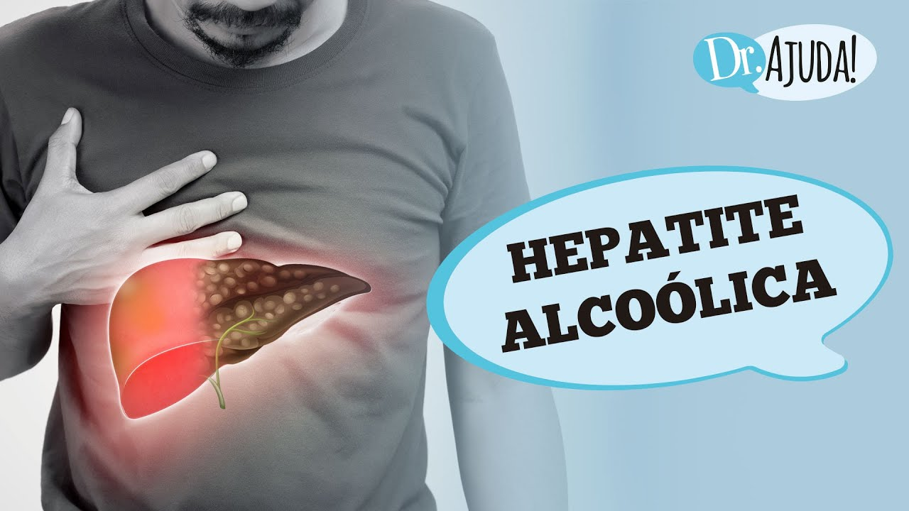 Hepatite Alcoólica e Cirrose: sintomas, diagnóstico e tratamento